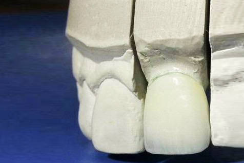 Protetyka stomatologiczna Białystok